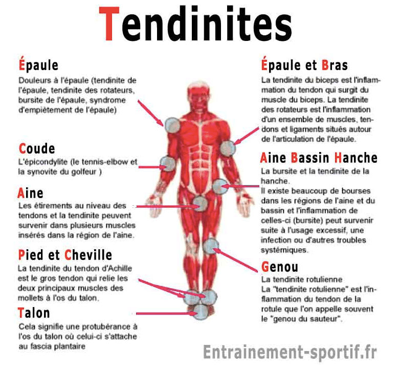 tendinites