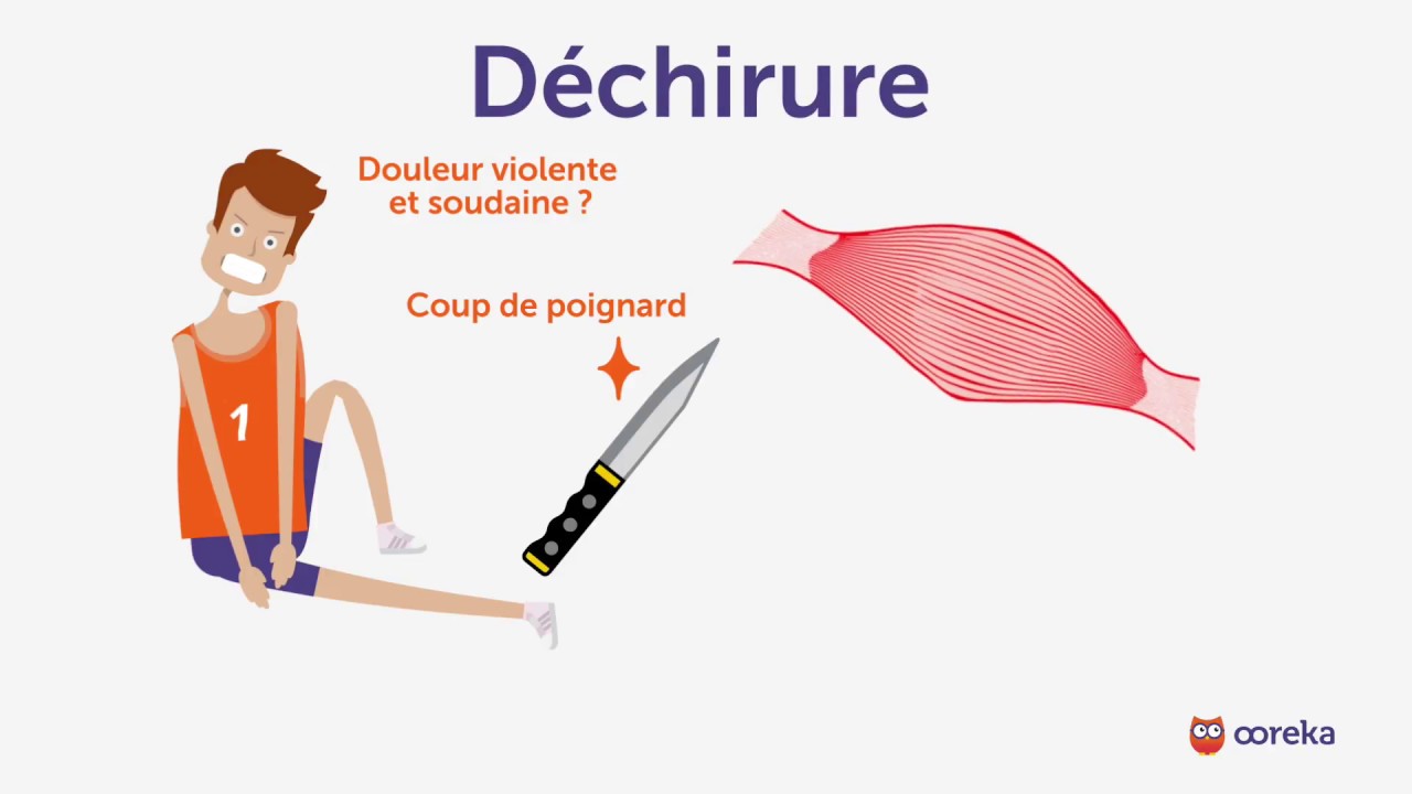 déchirure-symptomes - Musculation-Nutrition.fr