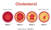qu'est ce que le cholesterol ?